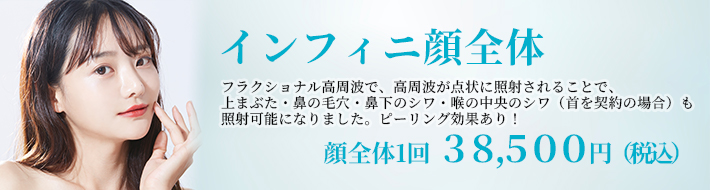 インフィニハイブリッドバナー
